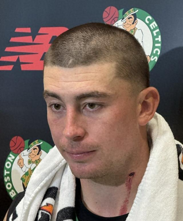 训练营内斗争激烈，普理查德血痕说明一切！