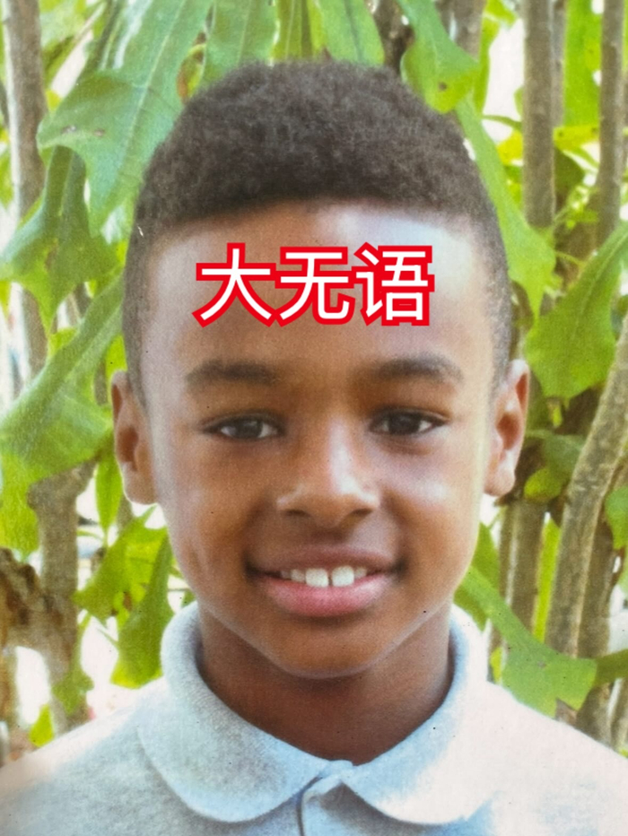 篮球强度局下的“伤痛日常”