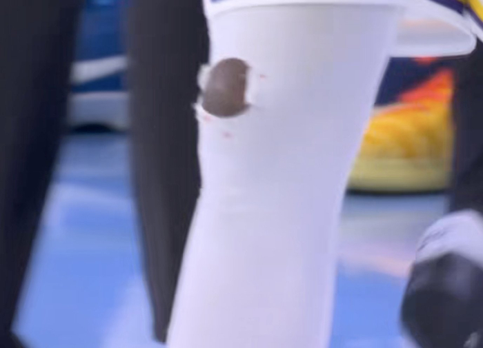 30多岁的斯玛特膝盖出问题，NBA球迷又要为防守买单？