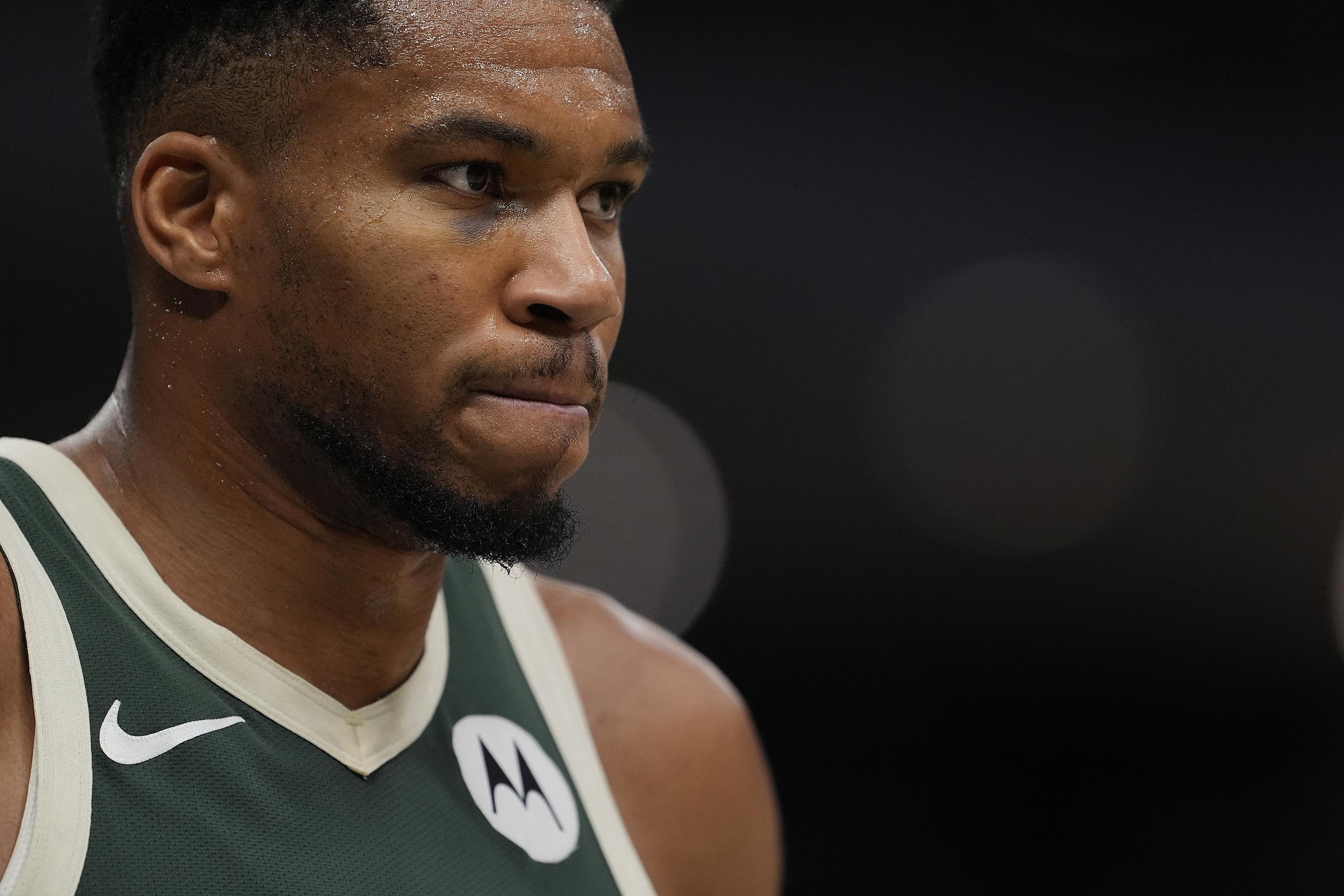 雄鹿133-135惜败国王，字母哥26+11但眼部淤青抢戏，NBA又一夜戏精上场