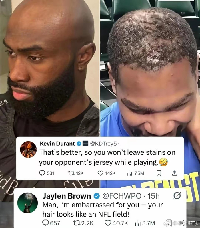 NBA凯文·杜兰特布朗暴露秃顶，谁才是真正的头发危机？